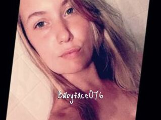 Babyface076