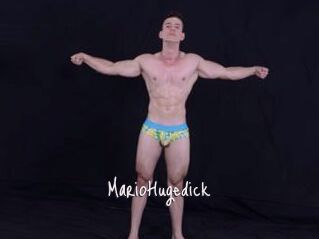 MarioHugedick
